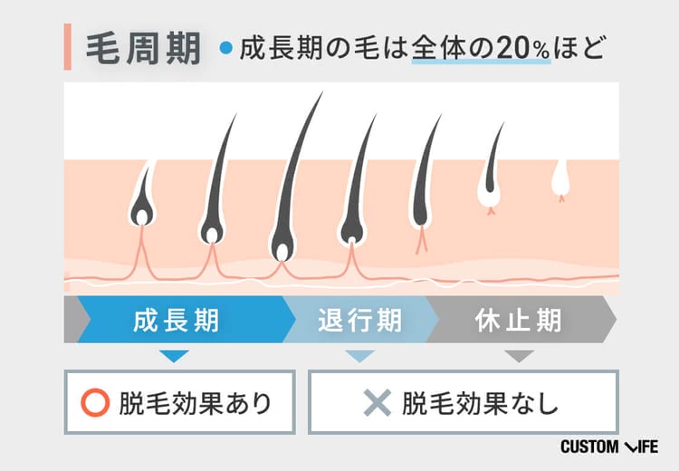 メンズ医療脱毛,おすすめ