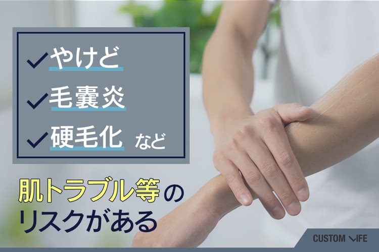 メンズ脱毛サロン