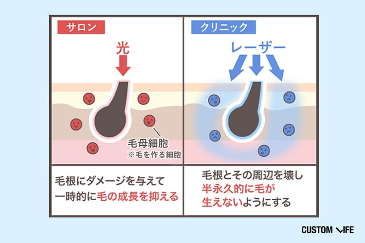 クリニックとサロンの違い