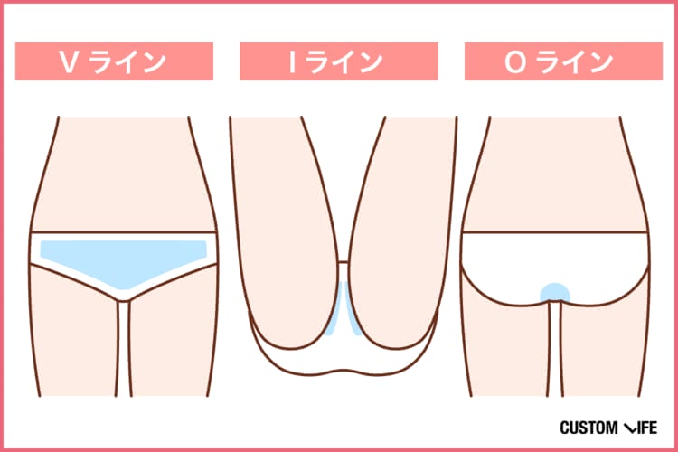 Vライン、Iライン、Oライン